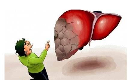 頭部出現(xiàn)這4種狀況，就要注意你的肝了！